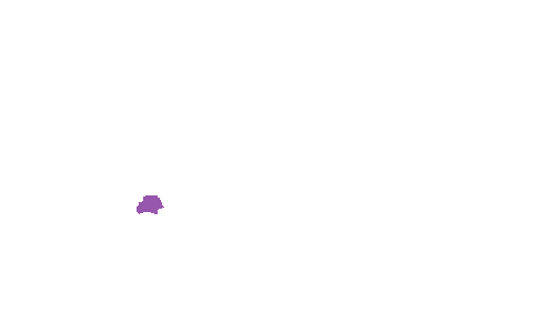 Sample annotation mask from Accurate Nevus Shapes