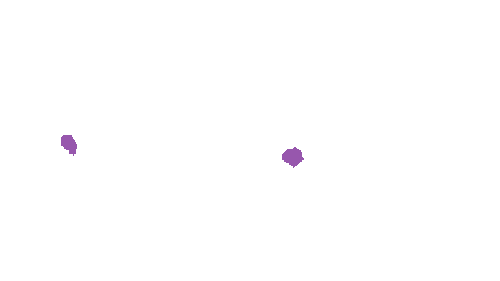 Sample annotation mask from Accurate Nevus Shapes