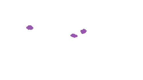 Sample annotation mask from Accurate Nevus Shapes