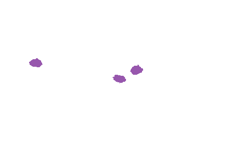 Sample annotation mask from Accurate Nevus Shapes