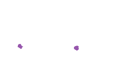 Sample annotation mask from Accurate Nevus Shapes