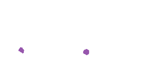 Sample annotation mask from Accurate Nevus Shapes