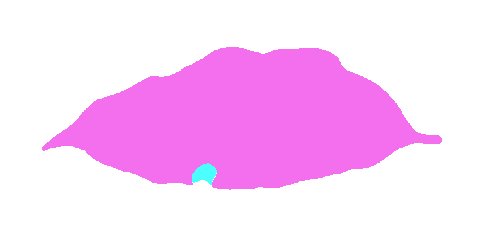 Sample annotation mask from Coffee Leaf Biotic Stress