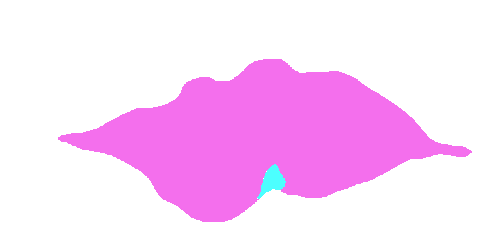 Sample annotation mask from Coffee Leaf Biotic Stress