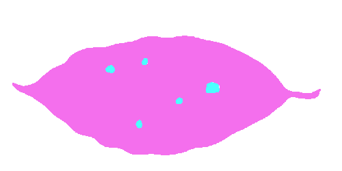 Sample annotation mask from Coffee Leaf Biotic Stress