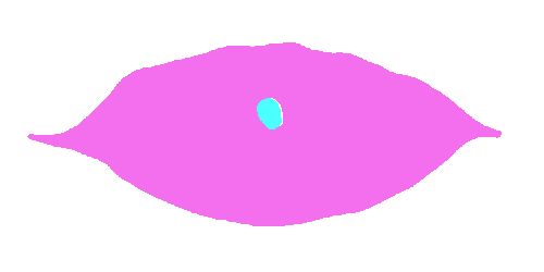 Sample annotation mask from Coffee Leaf Biotic Stress