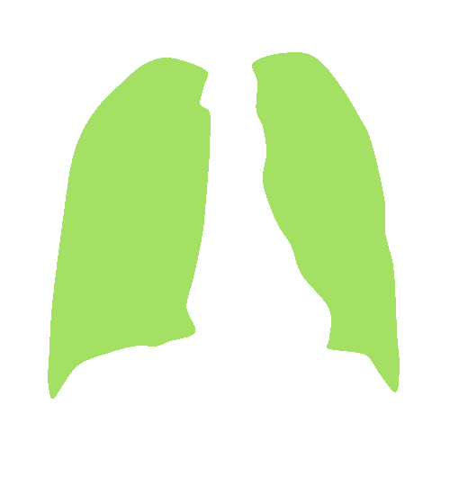 Sample annotation mask from Chest Xray Masks and Labels