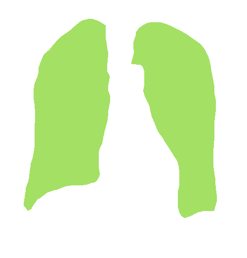 Sample annotation mask from Chest Xray Masks and Labels