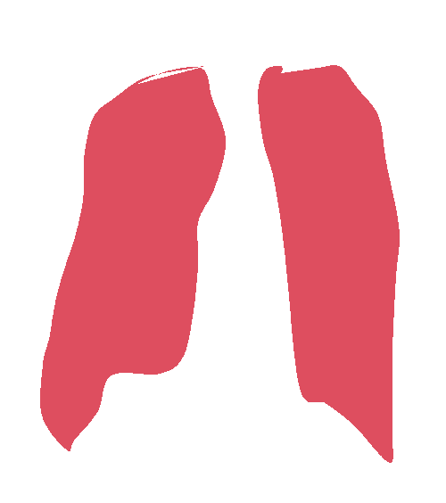 Sample annotation mask from Chest Xray Masks and Labels