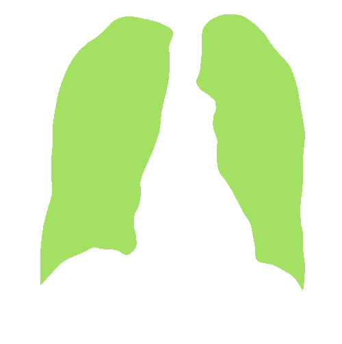 Sample annotation mask from Chest Xray Masks and Labels