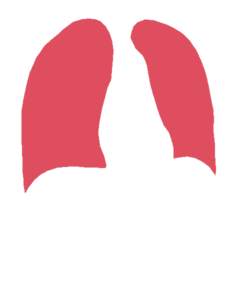 Sample annotation mask from Chest Xray Masks and Labels