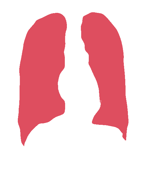 Sample annotation mask from Chest Xray Masks and Labels