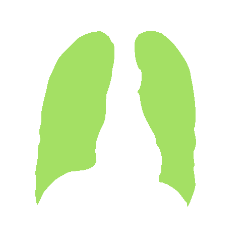 Sample annotation mask from Chest Xray Masks and Labels