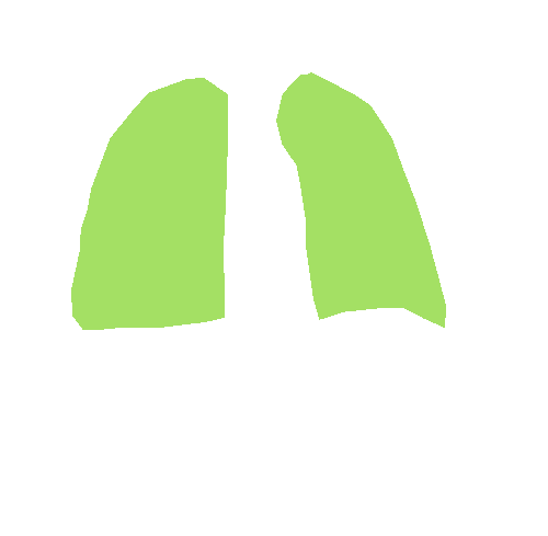 Sample annotation mask from Chest Xray Masks and Labels