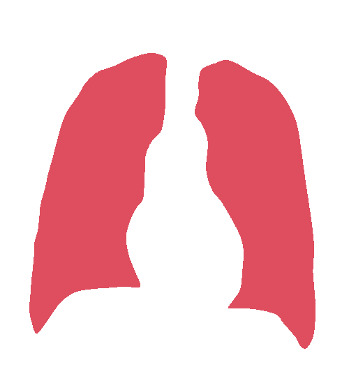 Sample annotation mask from Chest Xray Masks and Labels