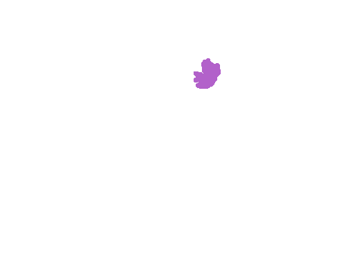 Sample annotation mask from Plasmodium Falciparum from Images of Giemsa for Malaria Detection