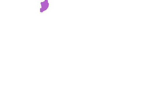 Sample annotation mask from Plasmodium Falciparum from Images of Giemsa for Malaria Detection