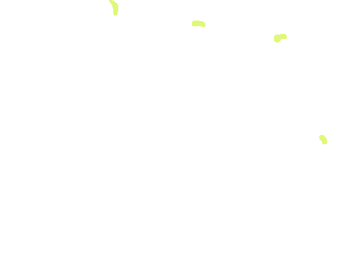 Sample annotation mask from Plasmodium Falciparum from Images of Giemsa for Malaria Detection