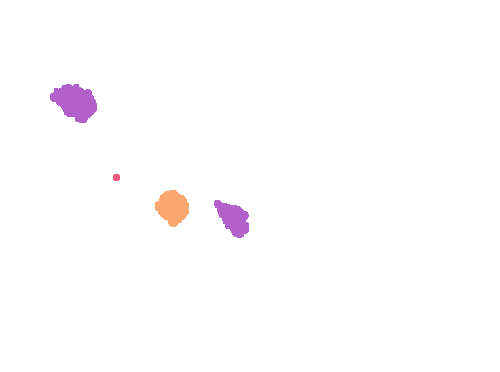 Sample annotation mask from Plasmodium Falciparum from Images of Giemsa for Malaria Detection