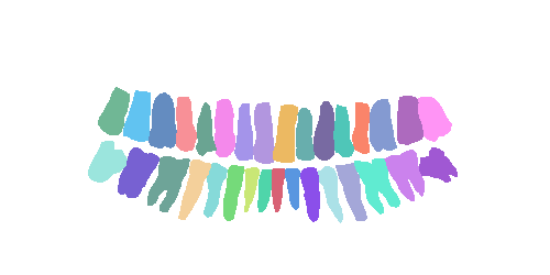 Sample annotation mask from Teeth Segmentation on Dental X-ray Images