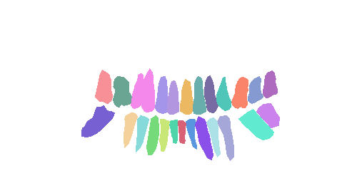 Sample annotation mask from Teeth Segmentation on Dental X-ray Images