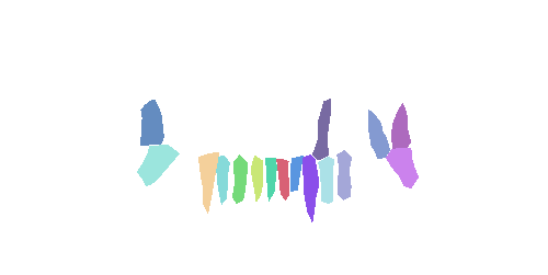 Sample annotation mask from Teeth Segmentation on Dental X-ray Images