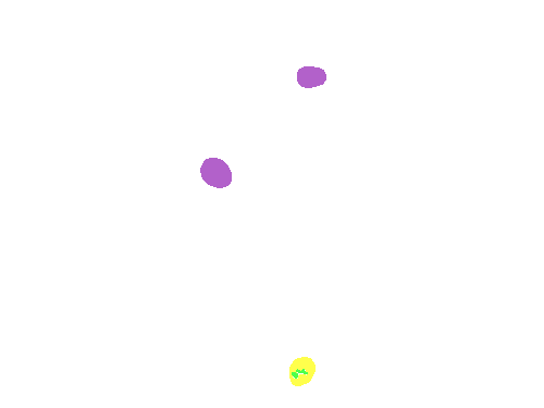 Sample annotation mask from CCAgT