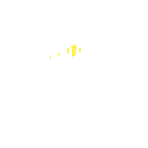 Sample annotation mask from Intraretinal Cystoid Fluid