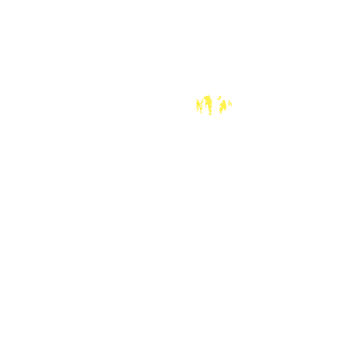 Sample annotation mask from Intraretinal Cystoid Fluid