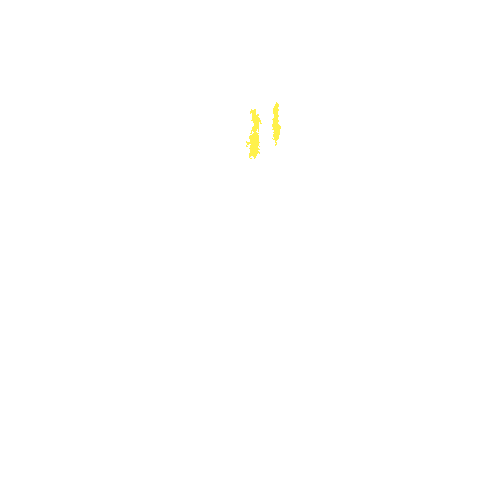 Sample annotation mask from Intraretinal Cystoid Fluid