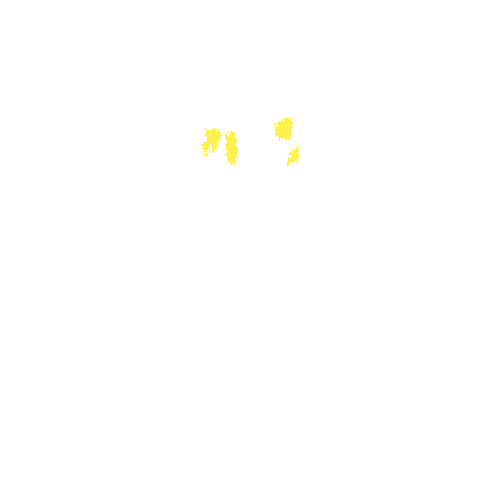 Sample annotation mask from Intraretinal Cystoid Fluid