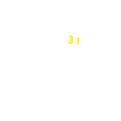 Sample annotation mask from Intraretinal Cystoid Fluid