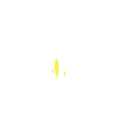 Sample annotation mask from Intraretinal Cystoid Fluid