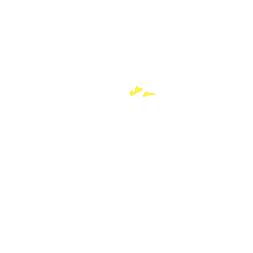 Sample annotation mask from Intraretinal Cystoid Fluid