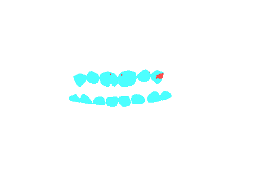 Sample annotation mask from Dentalai