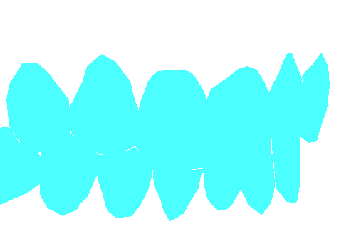 Sample annotation mask from Dentalai