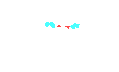 Sample annotation mask from Dentalai