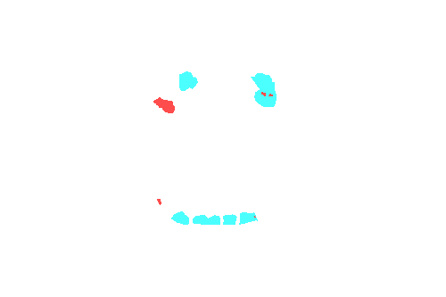 Sample annotation mask from Dentalai