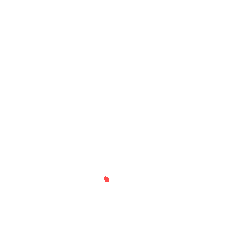 Sample annotation mask from CBIS-DDSM