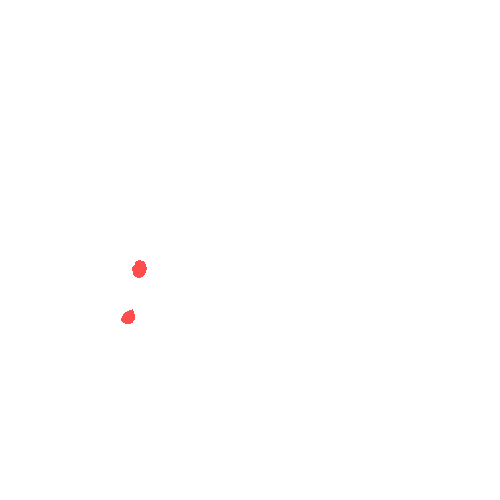 Sample annotation mask from CBIS-DDSM