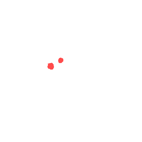 Sample annotation mask from CBIS-DDSM