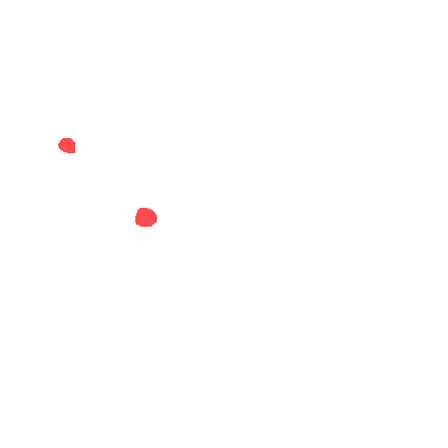 Sample annotation mask from CBIS-DDSM