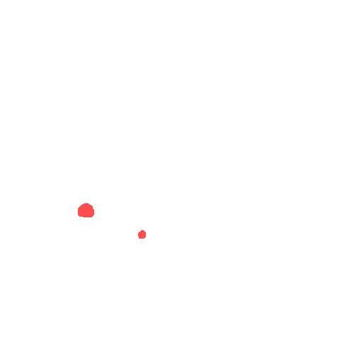 Sample annotation mask from CBIS-DDSM