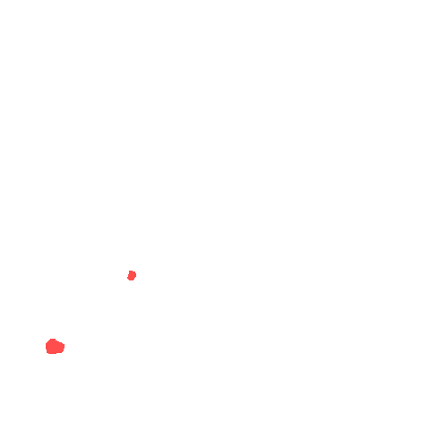 Sample annotation mask from CBIS-DDSM