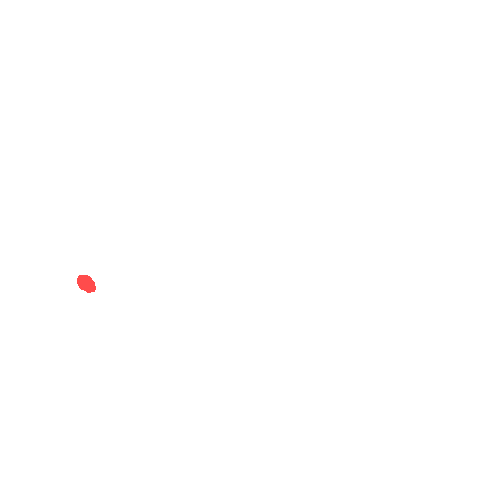 Sample annotation mask from CBIS-DDSM