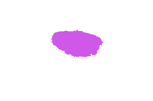 Sample annotation mask from ISIC 2017: Part 1 - Lesion Segmentation