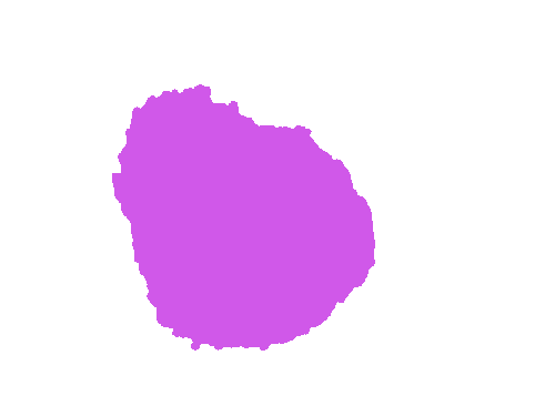 Sample annotation mask from ISIC 2017: Part 1 - Lesion Segmentation