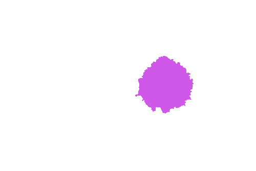 Sample annotation mask from ISIC 2017: Part 1 - Lesion Segmentation