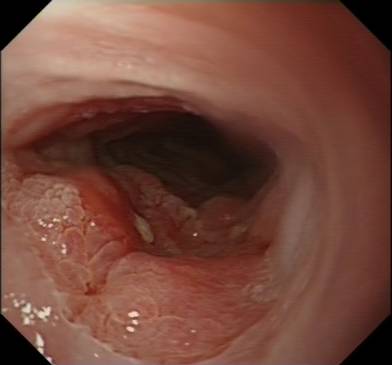 Sample image from EDD2020