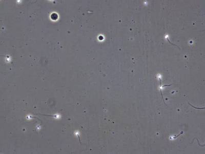 Sample image from VISEM-Tracking